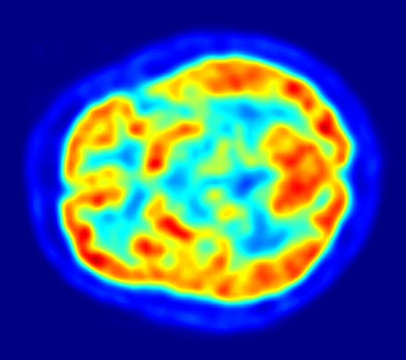 Cerveau humain -  tranche transaxiale (tomographie) / image de Jens Maus (1)